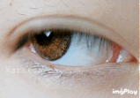 Venue Eyes(ヴィーナスアイズ)メガブリリアントブラウンのカラコン装着画像／別パターン